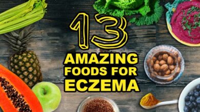 Eczema diet foods food avoid eat get healthline article allergies rid nummular saved club