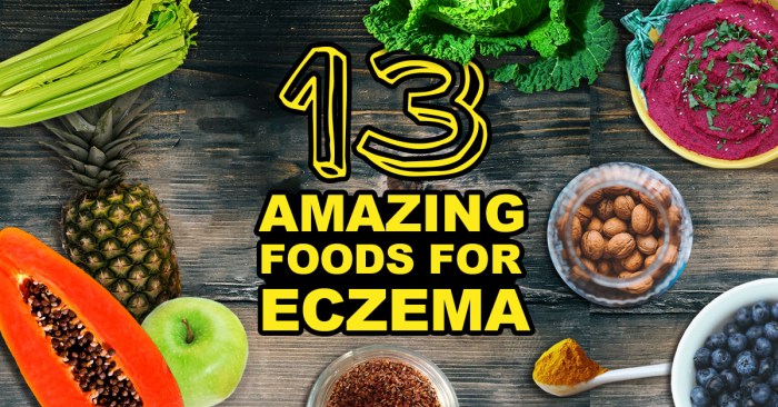 Eczema diet foods food avoid eat get healthline article allergies rid nummular saved club