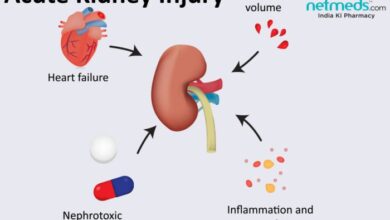 Kidney