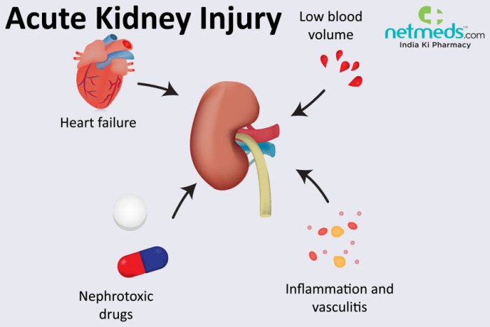 Kidney