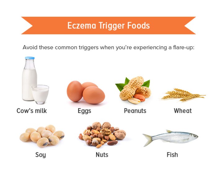 Diet bisa bantu penyembuhan eksim benarkah