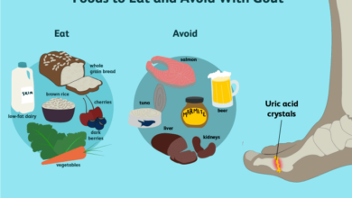 Hindari 9 makanan ini agar asam urat tidak kumat